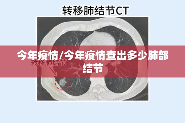 今年疫情/今年疫情查出多少肺部结节 今年疫情/今年疫情查出多少肺部结节