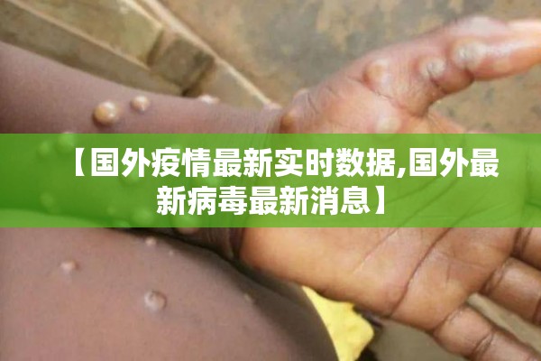 【国外疫情最新实时数据,国外最新病毒最新消息】